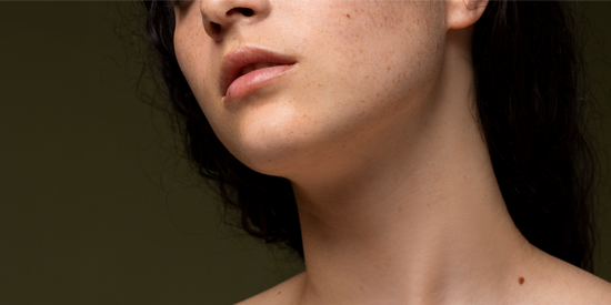 Best Skin Care Practices for People with Rosacea