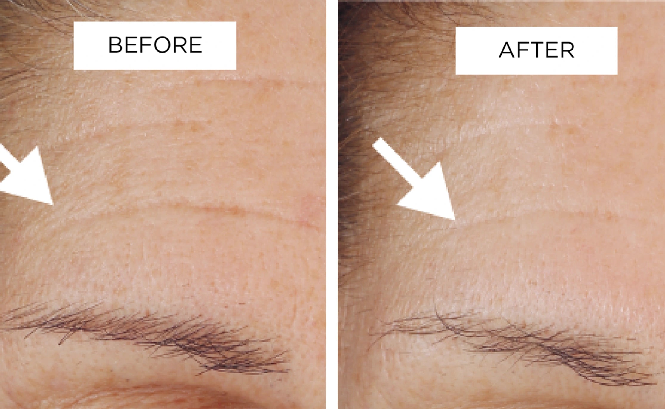 Veriphy'd by science | Clinical results | Before & After image