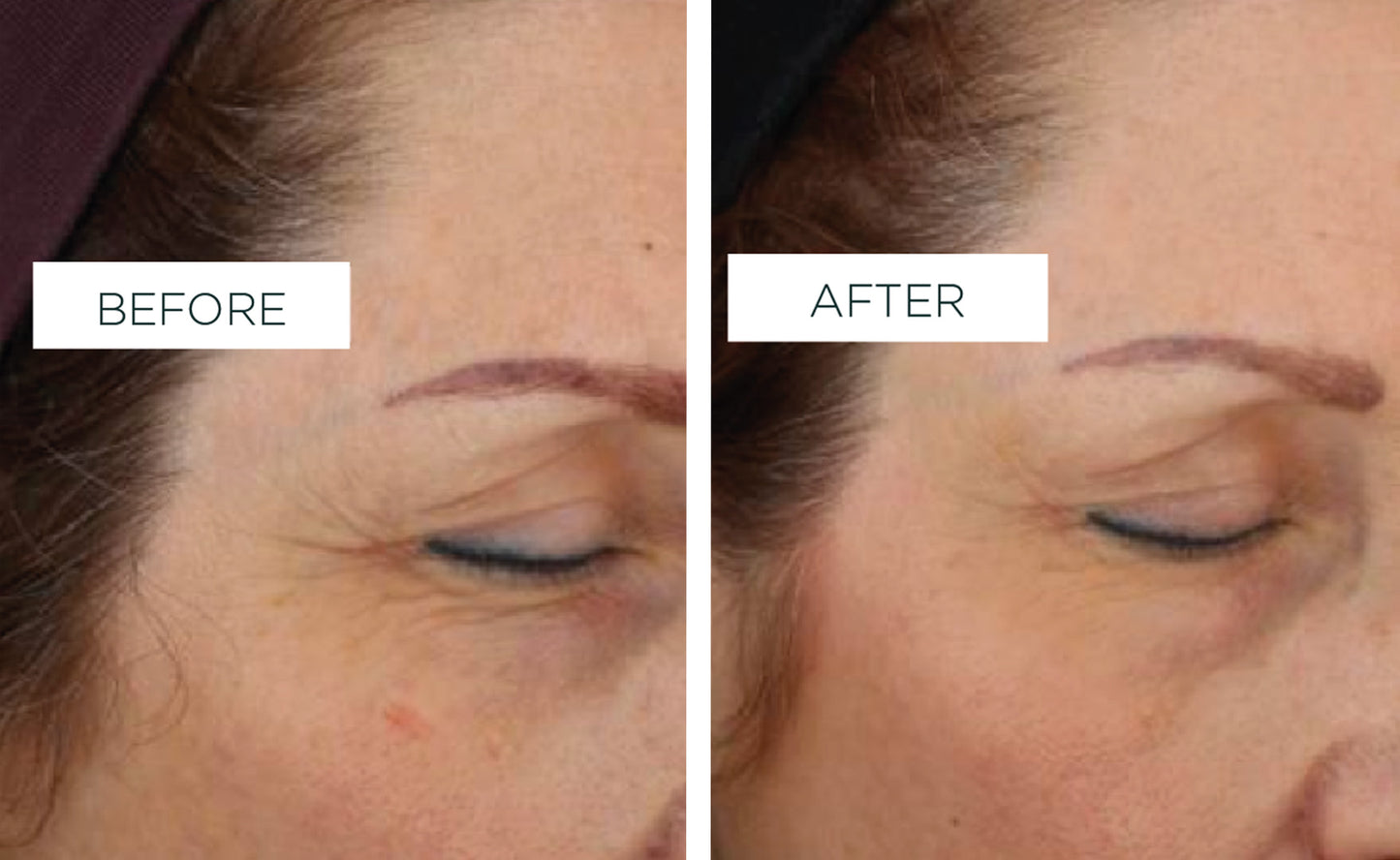 Veriphy'd by science | Clinical results | Before & After image
